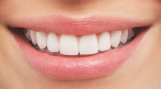 Professional Teeth Whitening - Brickell Dentistry - Reconstructive and Cosmetic Dentists in the heart of Miami